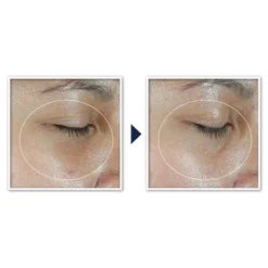 RoC Multi Correxion Revive And Glow Vitamin C Under Eye Balm - 0.14oz -Serene Skin GUEST 2257f731 69e1 45be bc83 a14a3820ee23