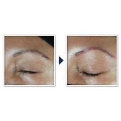 RoC Multi Correxion Hydrate + Plump Eye Cream With Hyaluronic Acid - 0.5oz -Serene Skin GUEST 282081b8 cf20 46ec 950a 40a45379a932