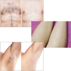 Spa Sciences LEXI IPL Permanent Hair Removal System For Face & Body, FDA Cleared -Serene Skin GUEST 2ee236fa 1241 4e74 82ea 31402e0c8e2c