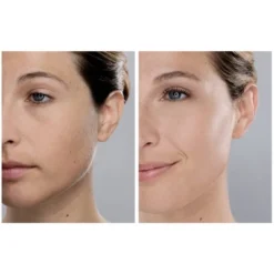 Spa Sciences SIMA Sonic Dermaplaning Tool For Exfoliation & Peach Fuzz Removal -Serene Skin GUEST 399f3f31 bd0c 4430 8baa bccdd1a64249