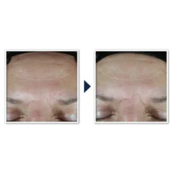 RoC Multi Correxion Hydrate + Plump Daily Moisturizer With Hyaluronic Acid - SPF 30 - 1.7oz 19 RoC Multi Correxion Hydrate + Plump Daily Moisturizer With Hyaluronic Acid - SPF 30 - 1.7oz -Serene Skin GUEST 4c655431 34e9 4002 aee8 975bcba07843