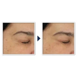 RoC Brightening Anti-Aging Moisturizer With Vitamin C For Uneven Tone - 1.7 Fl Oz -Serene Skin GUEST 75dc53e9 921e 409b 8d3e 6df9ae0ec9b4