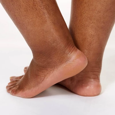 CeraVe Healing Ointment, Moisturizing Petrolatum Skin Protectant For Dry Skin Unscented - 3oz 9 CeraVe Healing Ointment, Moisturizing Petrolatum Skin Protectant For Dry Skin Unscented - 3oz - Image 7