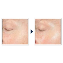 RoC Brightening Anti-Aging Moisturizer With Vitamin C For Uneven Tone - 1.7 Fl Oz -Serene Skin GUEST 9d0cdaa3 af91 47e0 b49f e56da792b395