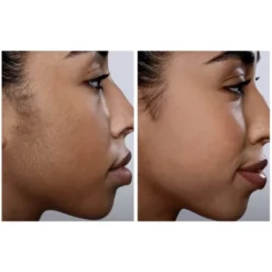 Spa Sciences SIMA Sonic Dermaplaning Tool For Exfoliation & Peach Fuzz Removal -Serene Skin GUEST 9e7f581e 7053 4a1e 8489 adca7b01f229