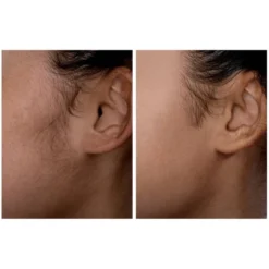 Spa Sciences SIMA Sonic Dermaplaning Tool For Exfoliation & Peach Fuzz Removal -Serene Skin GUEST aceb288f 7ab1 4a37 b0e7 2812bc3b1fe5