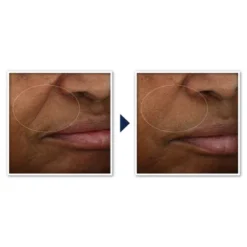 RoC Brightening Anti-Aging Moisturizer With Vitamin C For Uneven Tone - 1.7 Fl Oz -Serene Skin GUEST cc9432e8 2cd8 4299 a9fd 0b4fbbb114e9