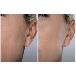 Spa Sciences SIMA Sonic Dermaplaning Tool For Exfoliation & Peach Fuzz Removal -Serene Skin GUEST d2b414d6 a0fe 49a9 a64c 8f567dbfeea6