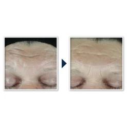 RoC Retinol Correxion Anti-Aging Retinol Moisturizer With Hydrating Hyaluronic Acid - 1.7oz -Serene Skin GUEST d5a6a74c c48f 4395 950a 75ca0d6141fe