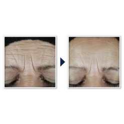 RoC Multi Correxion Hydrate + Plump Daily Moisturizer With Hyaluronic Acid - SPF 30 - 1.7oz 21 RoC Multi Correxion Hydrate + Plump Daily Moisturizer With Hyaluronic Acid - SPF 30 - 1.7oz -Serene Skin GUEST dbc1fe6c eba1 40e2 b2b1 dbc3843e94e2