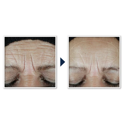 RoC Multi Correxion Hydrate + Plump Daily Moisturizer With Hyaluronic Acid - SPF 30 - 1.7oz 12 RoC Multi Correxion Hydrate + Plump Daily Moisturizer With Hyaluronic Acid - SPF 30 - 1.7oz - Image 10