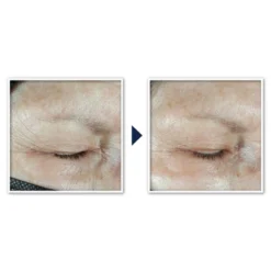 RoC Multi Correxion Hydrate + Plump Eye Cream With Hyaluronic Acid - 0.5oz -Serene Skin GUEST de016471 9c18 40f6 9520 eef1623c08bc